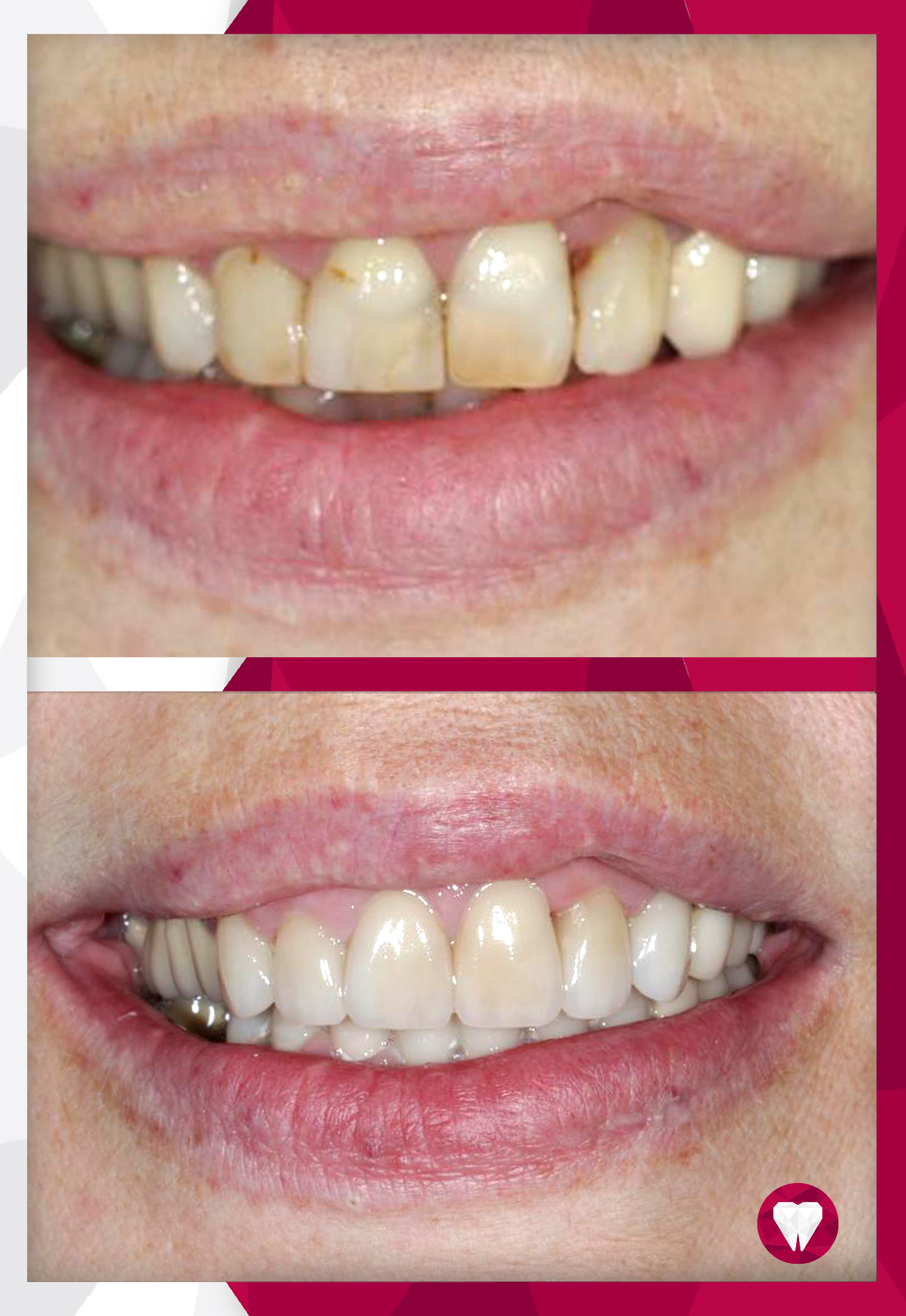 Сертификаты