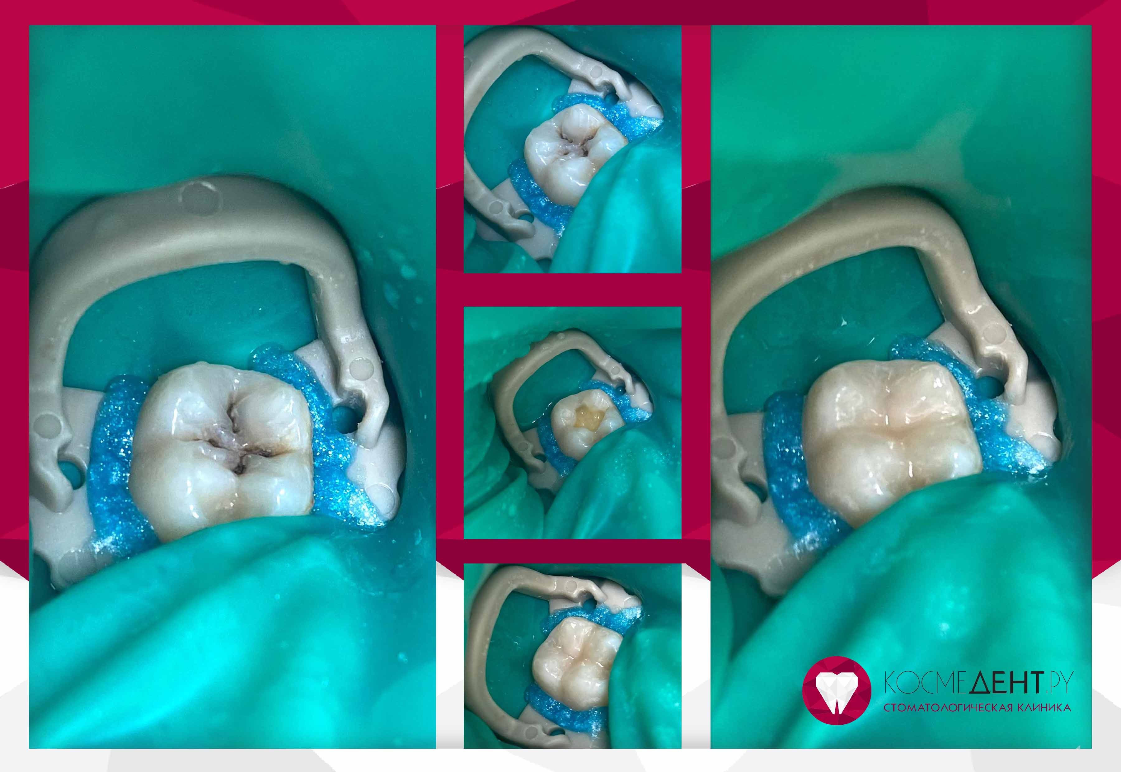 Сертификаты