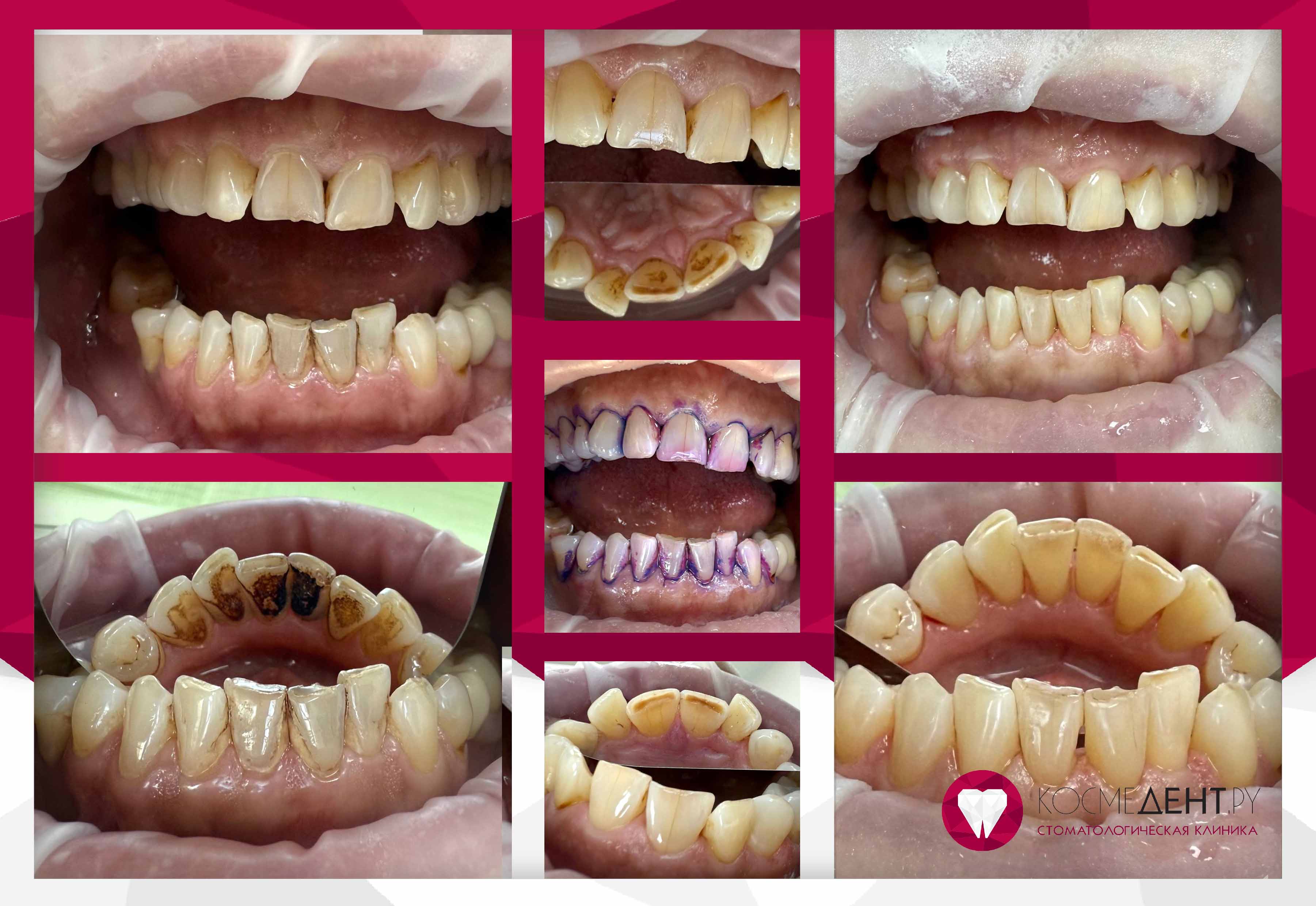 Сертификаты