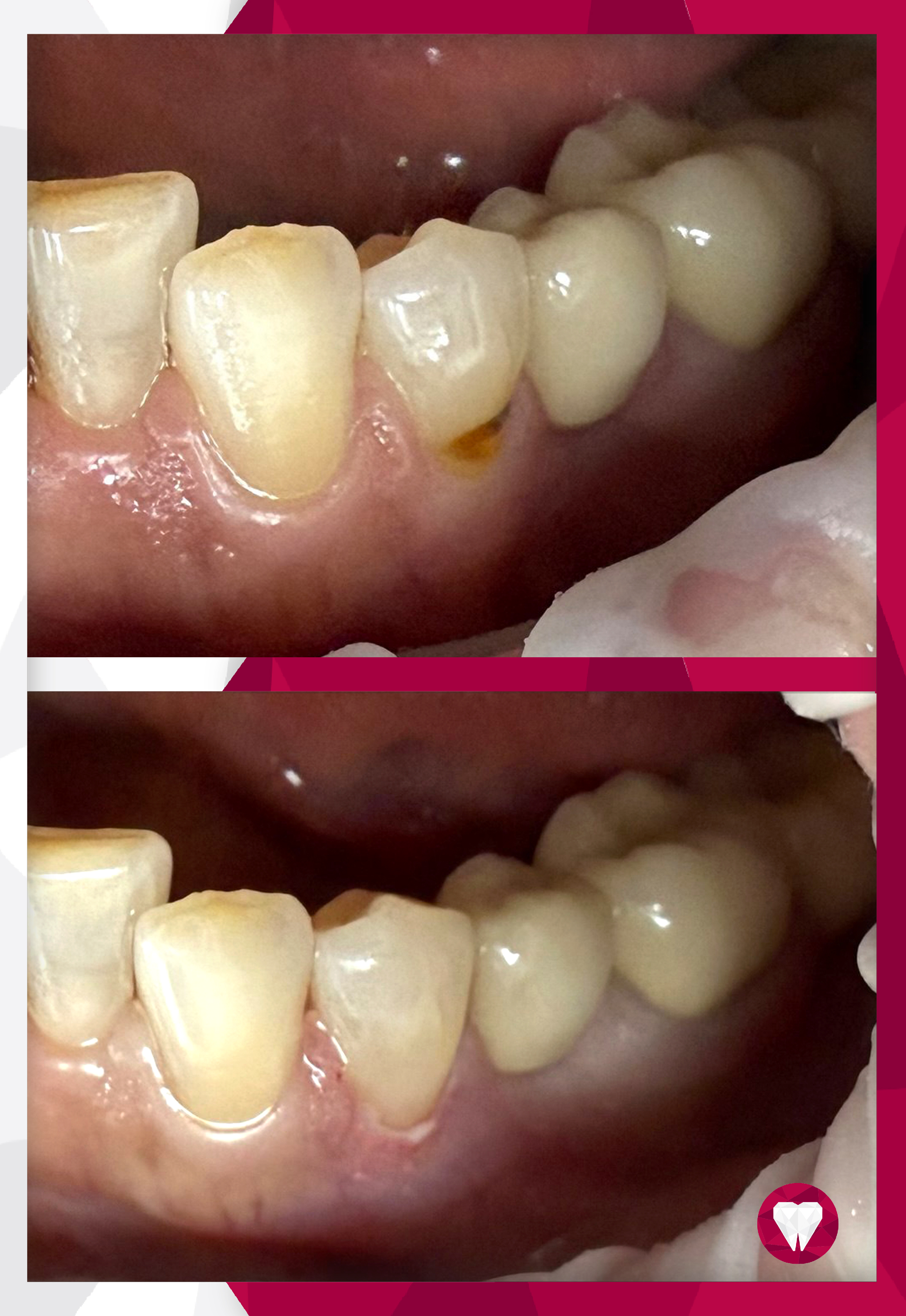 Сертификаты