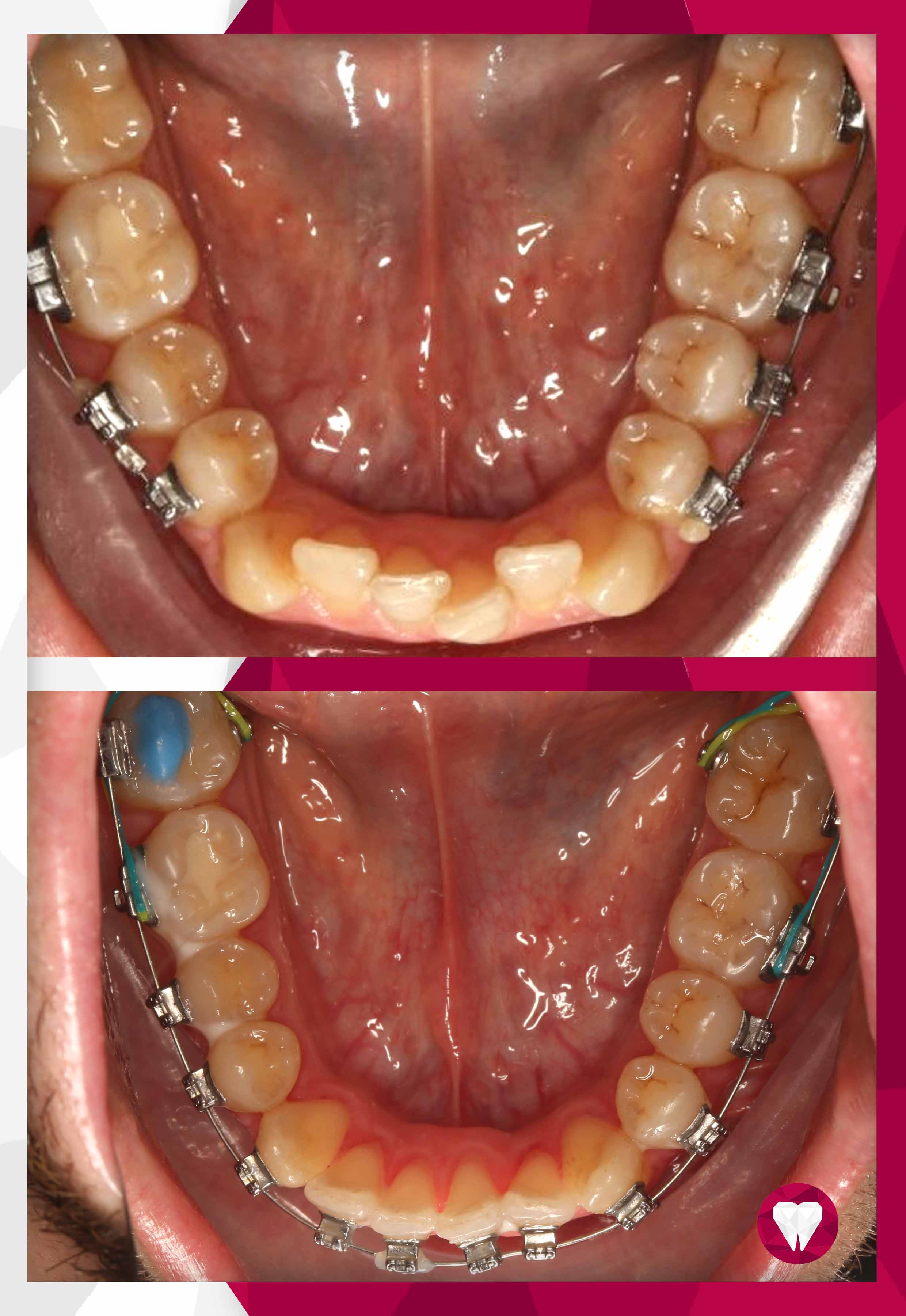 Сертификаты