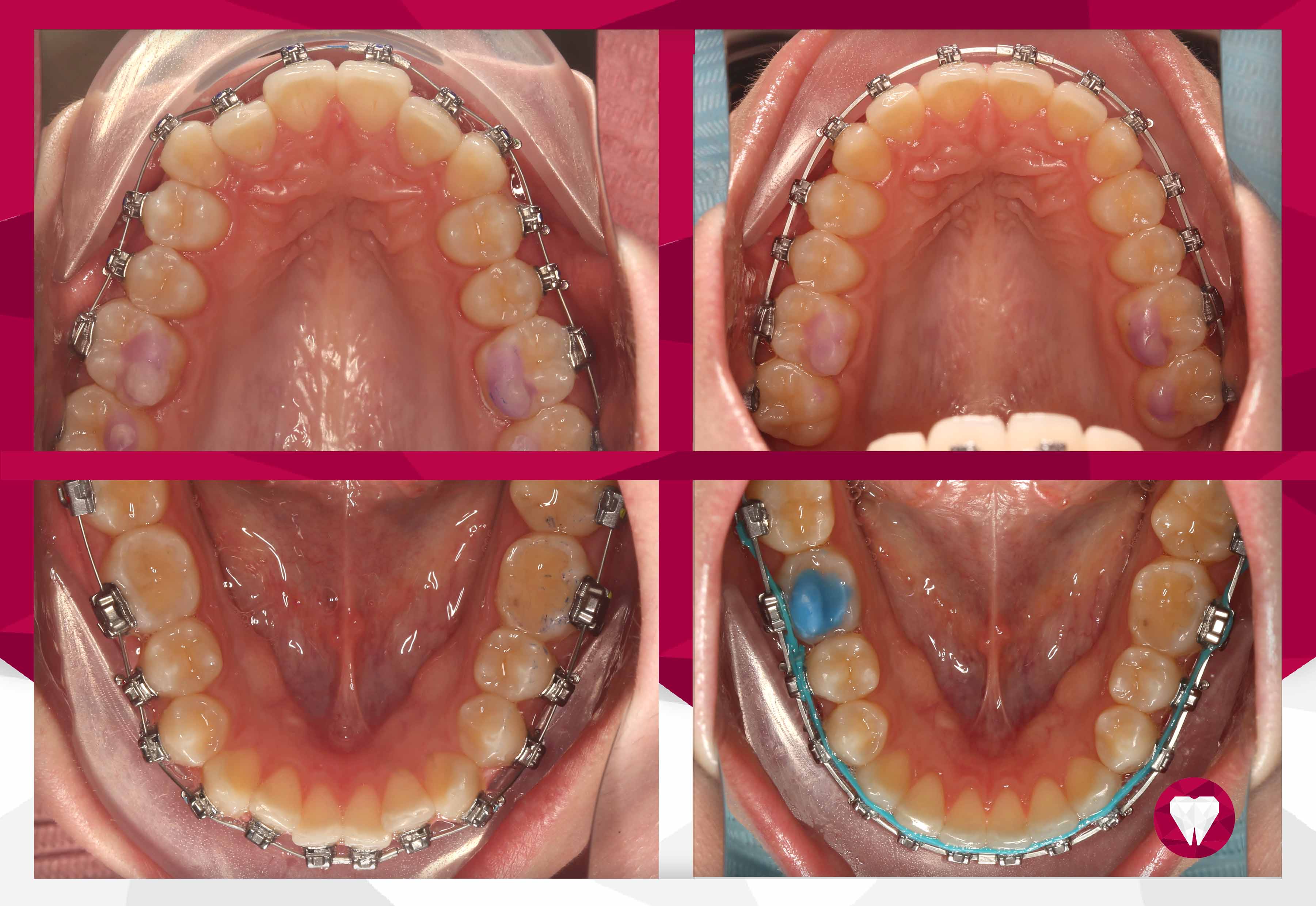 Сертификаты