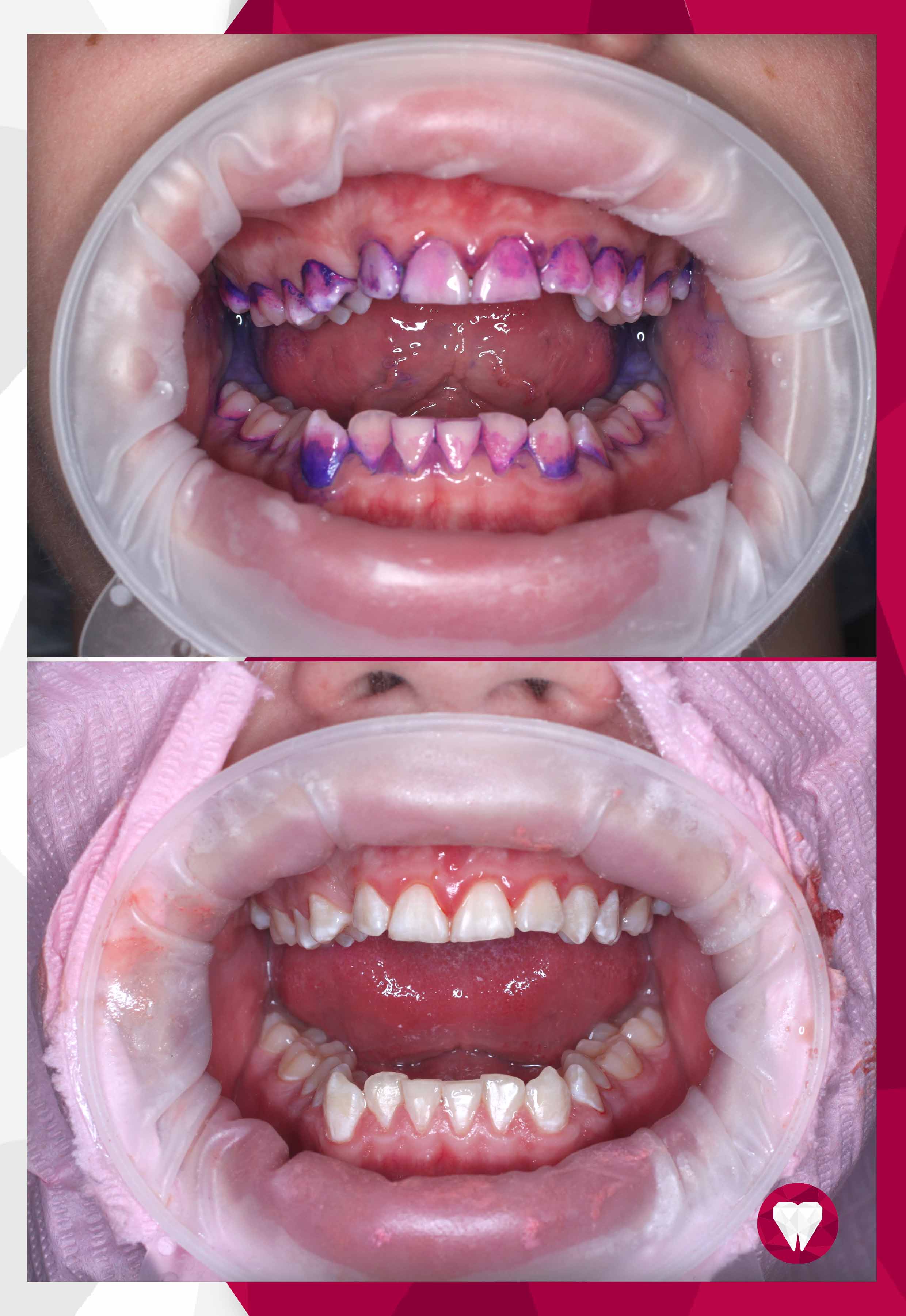 Сертификаты