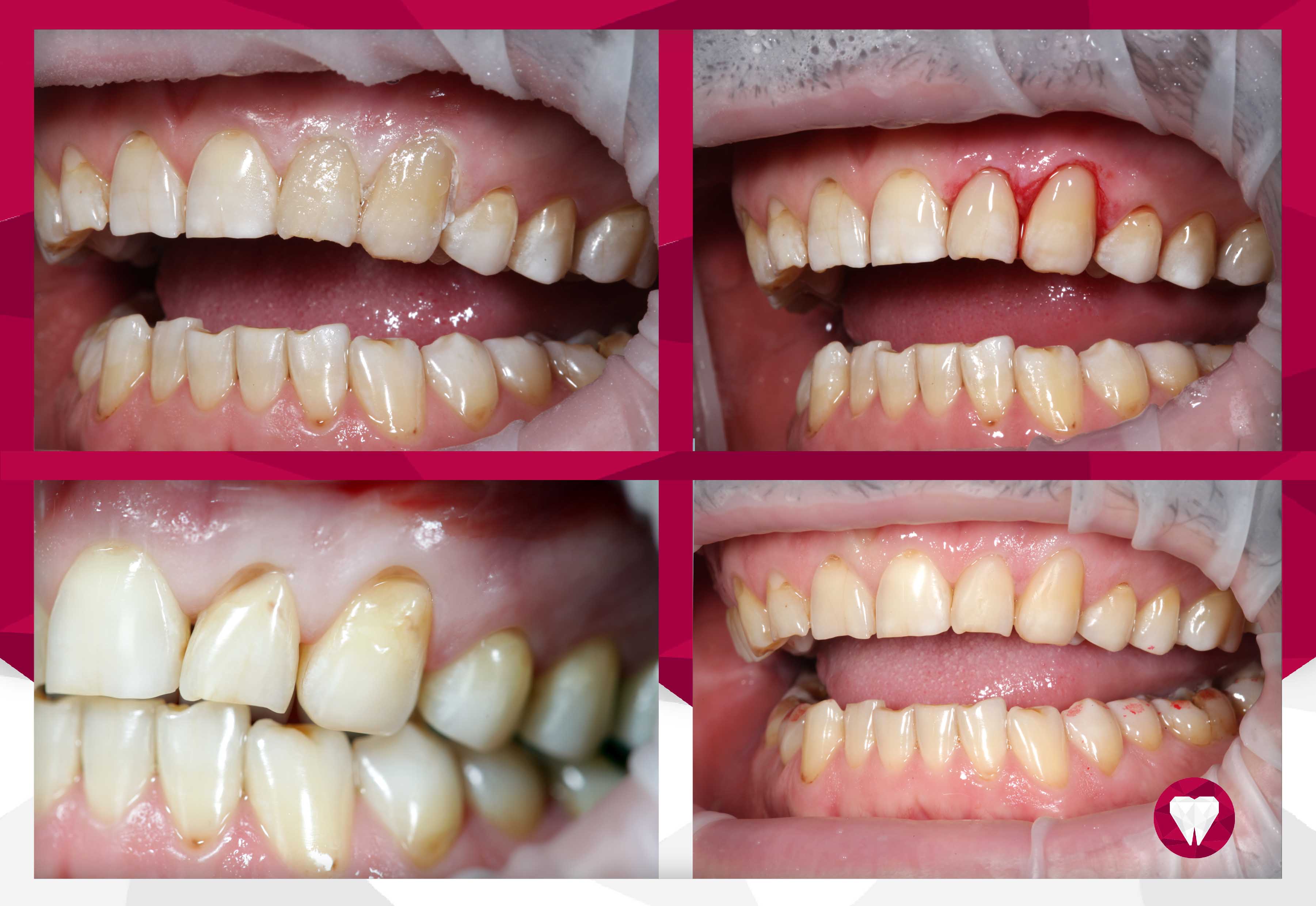 Сертификаты