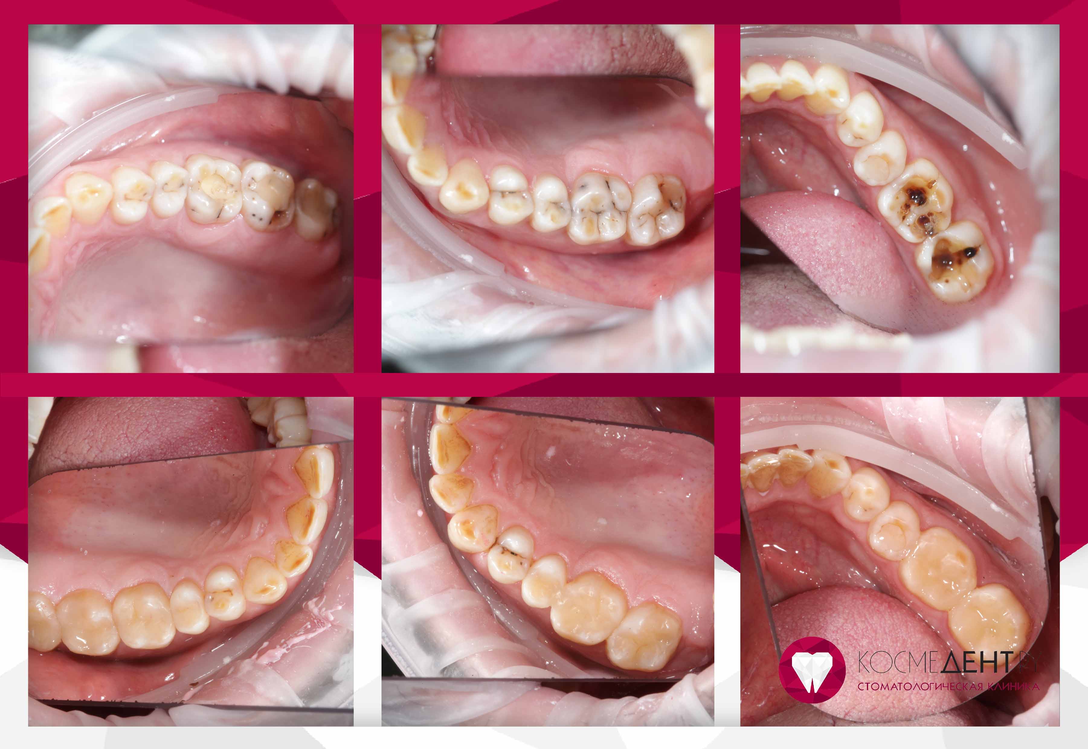 Сертификаты