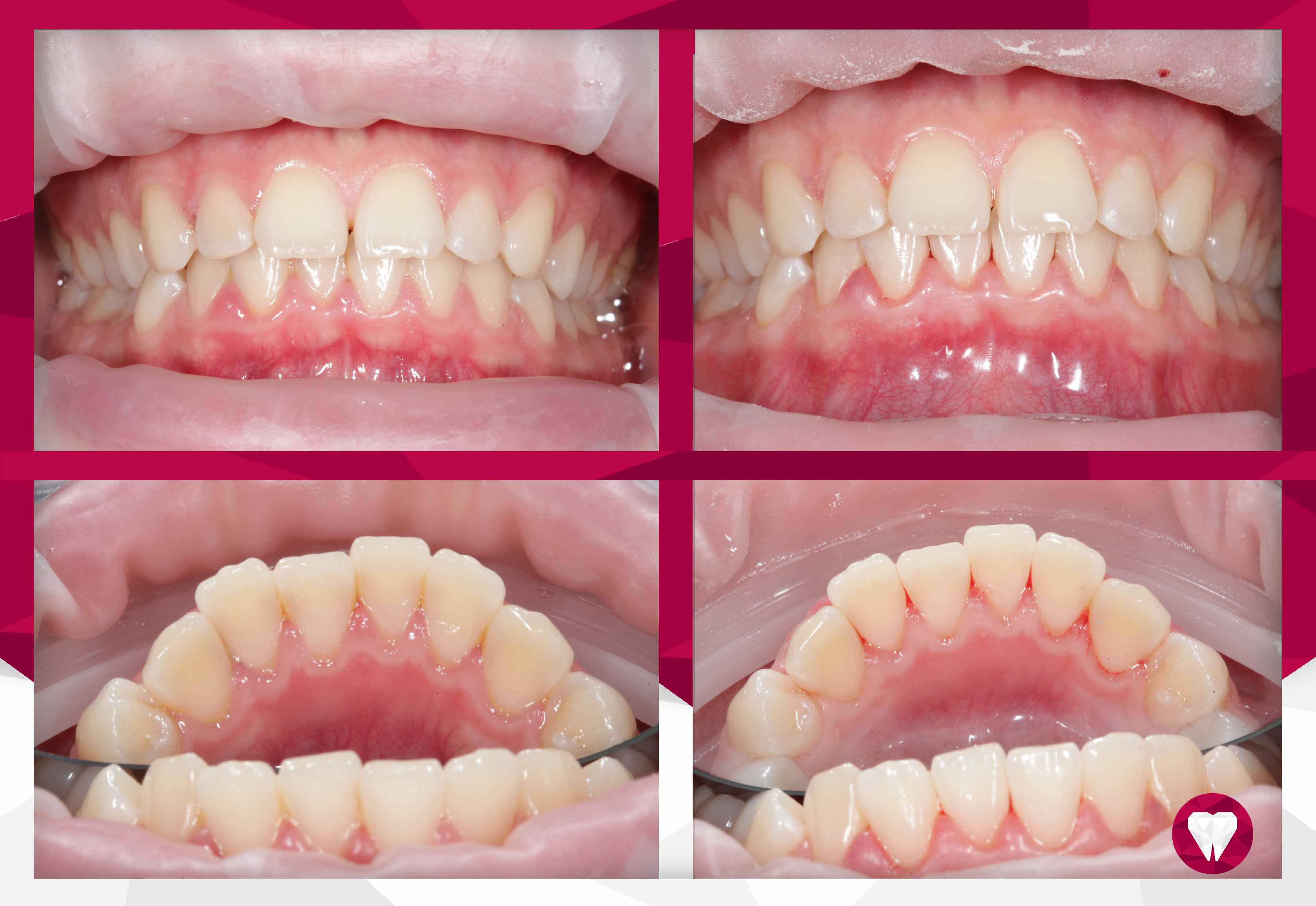 Сертификаты