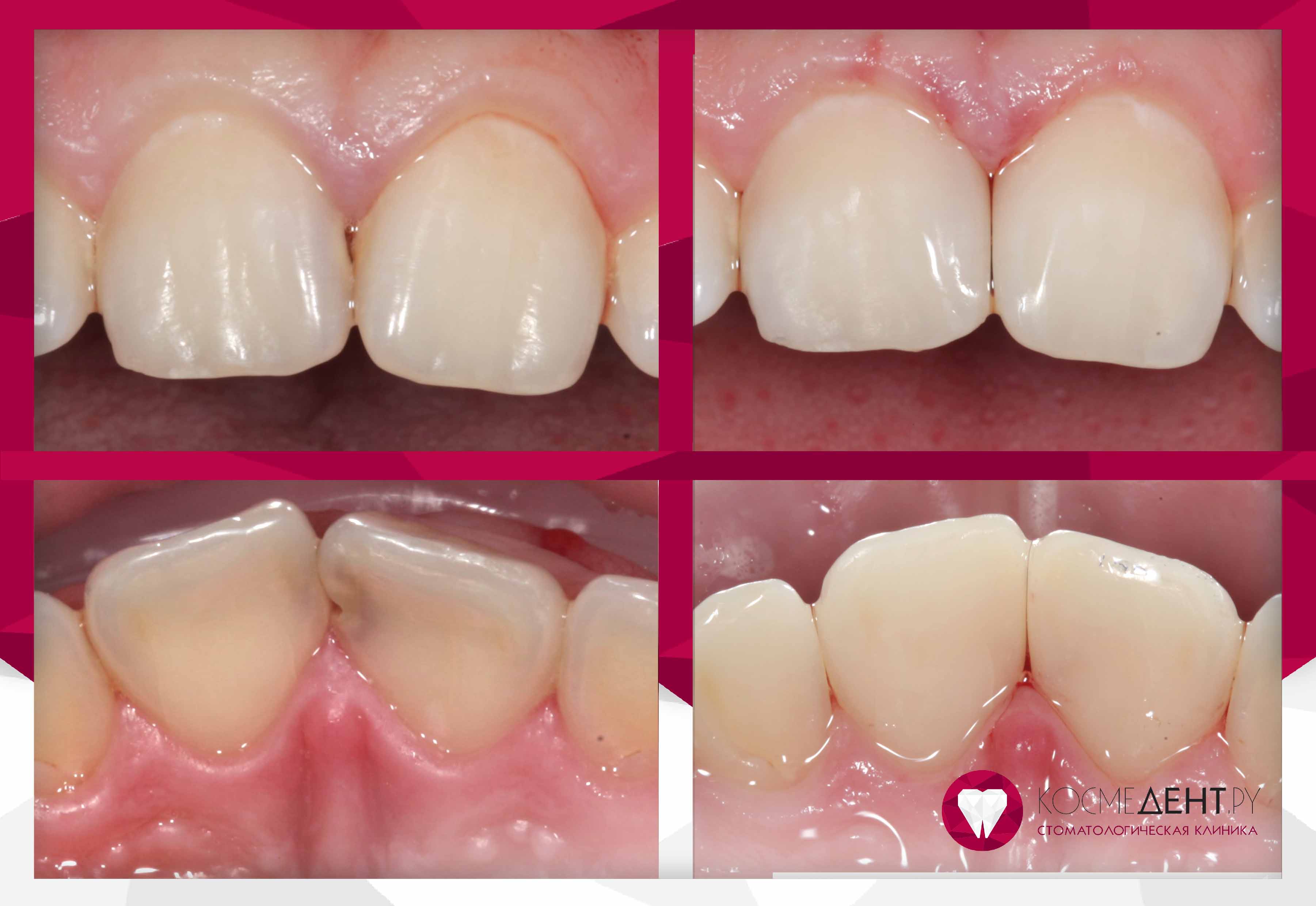 Сертификаты