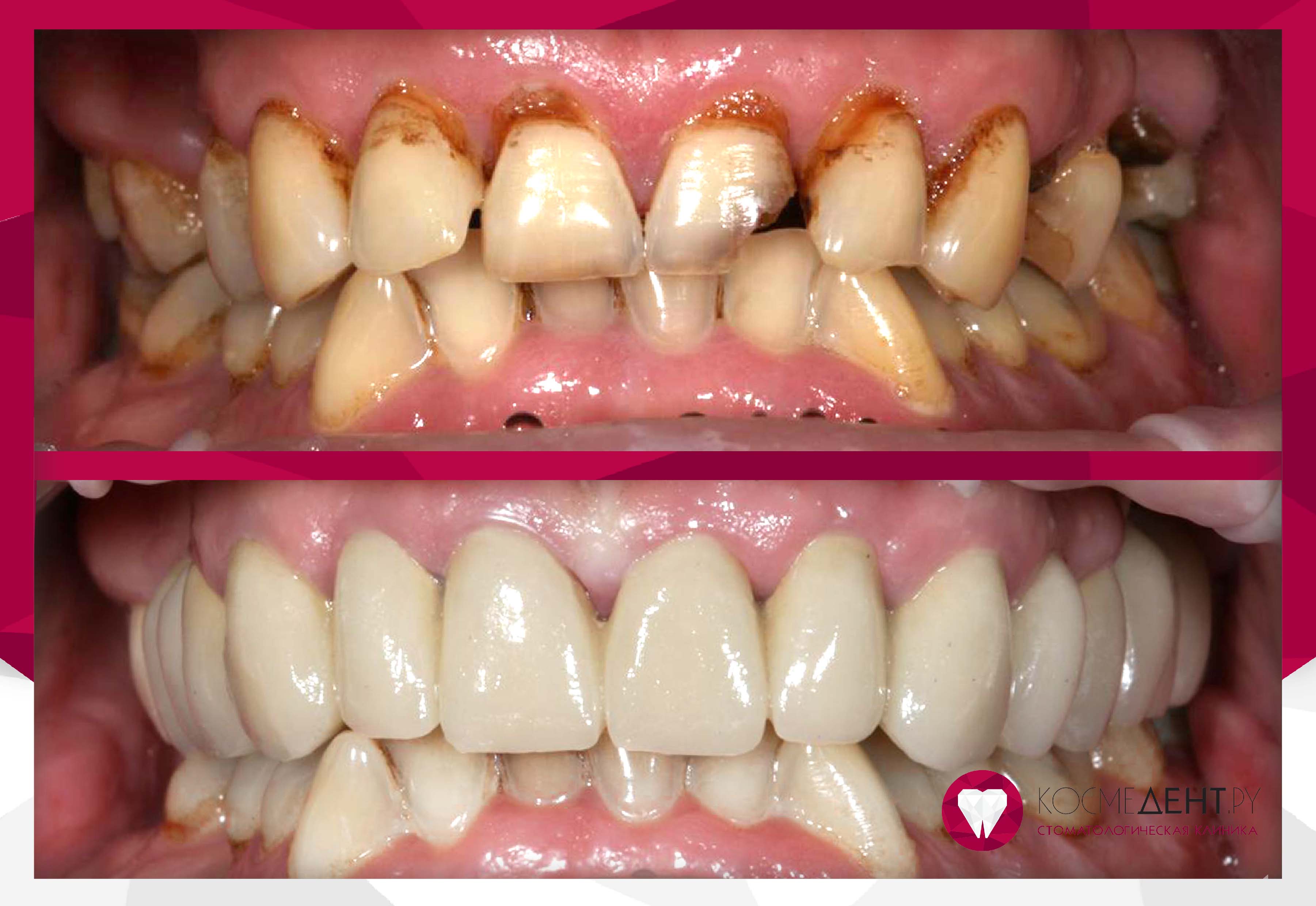 Сертификаты