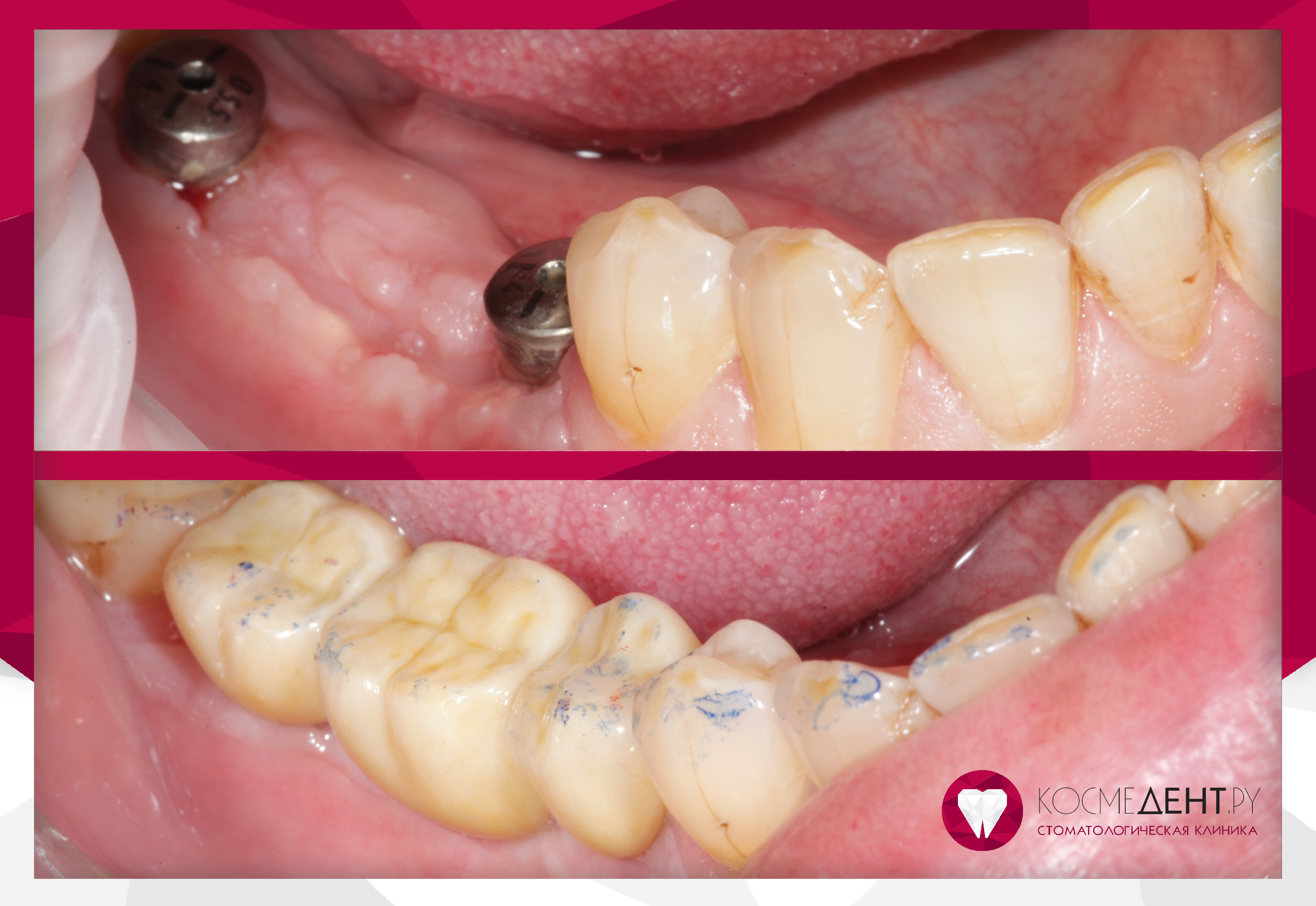 Сертификаты