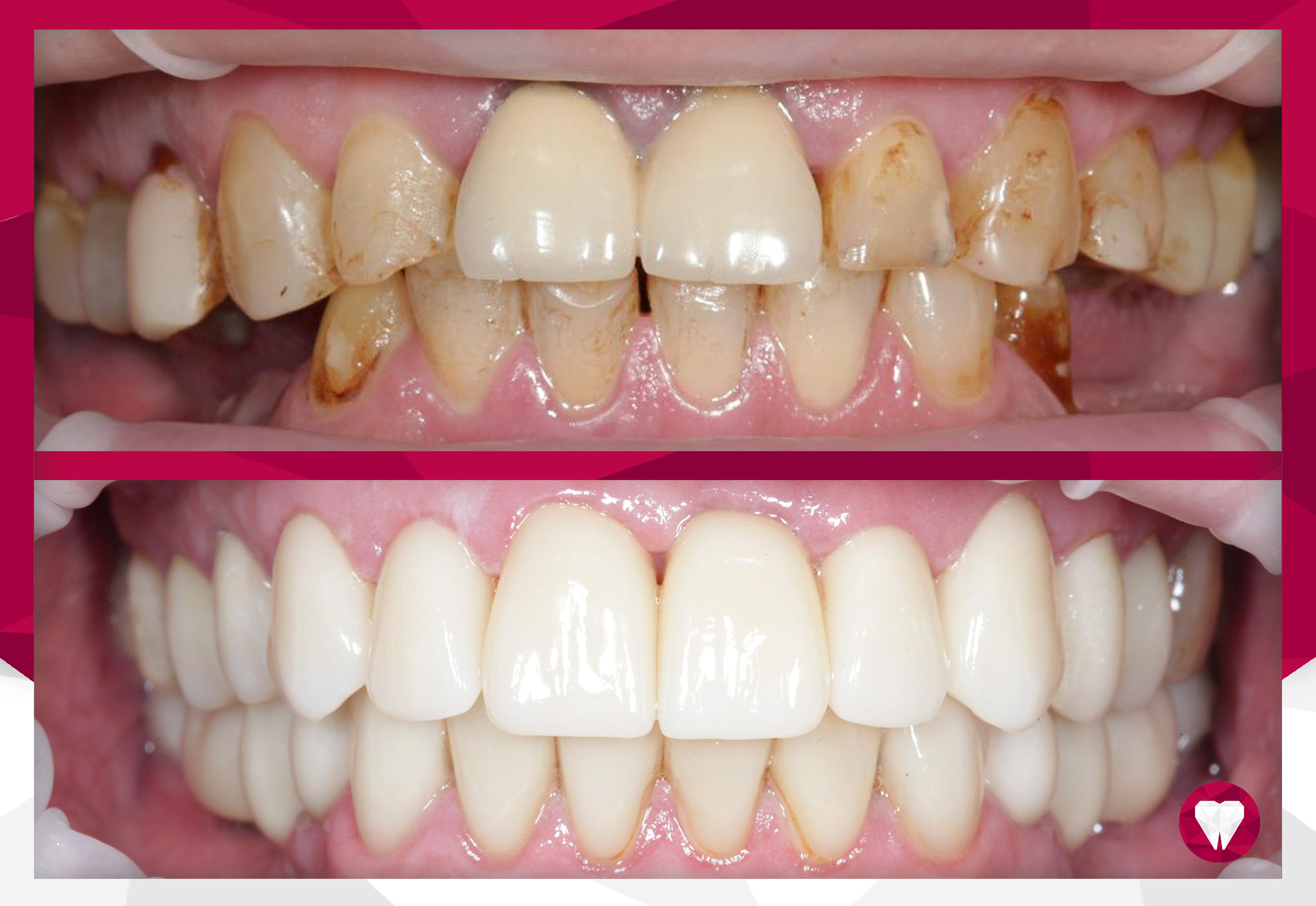 Сертификаты